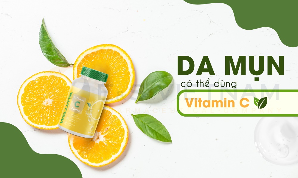 Da mụn có thể dùng Vitamin C