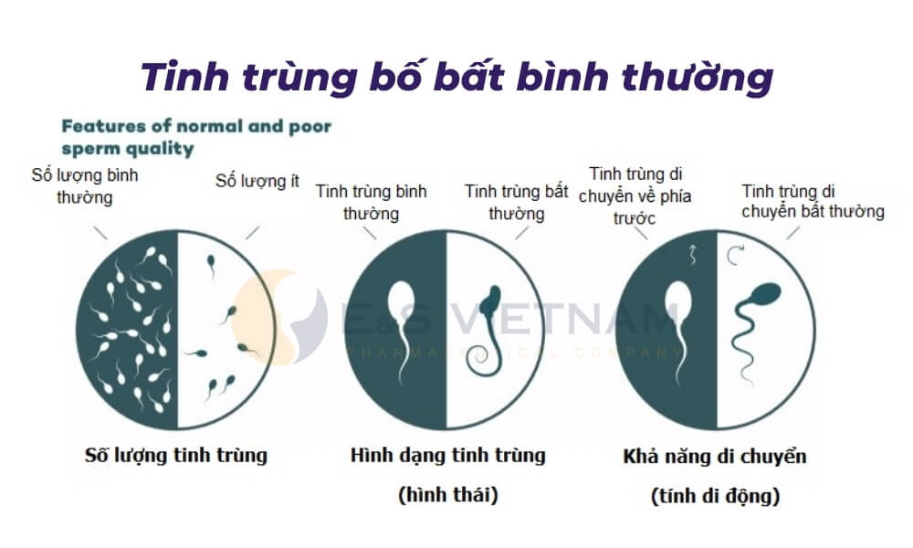 Tinh trùng ít, dị dạng, khả năng di động kém khiến cho bố mẹ khó có con dù quan hệ đúng ngày rụng trứng