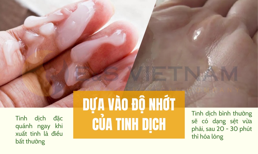 Dựa vào độ nhớt của tinh dịch để biết tinh trùng mạnh hay yếu