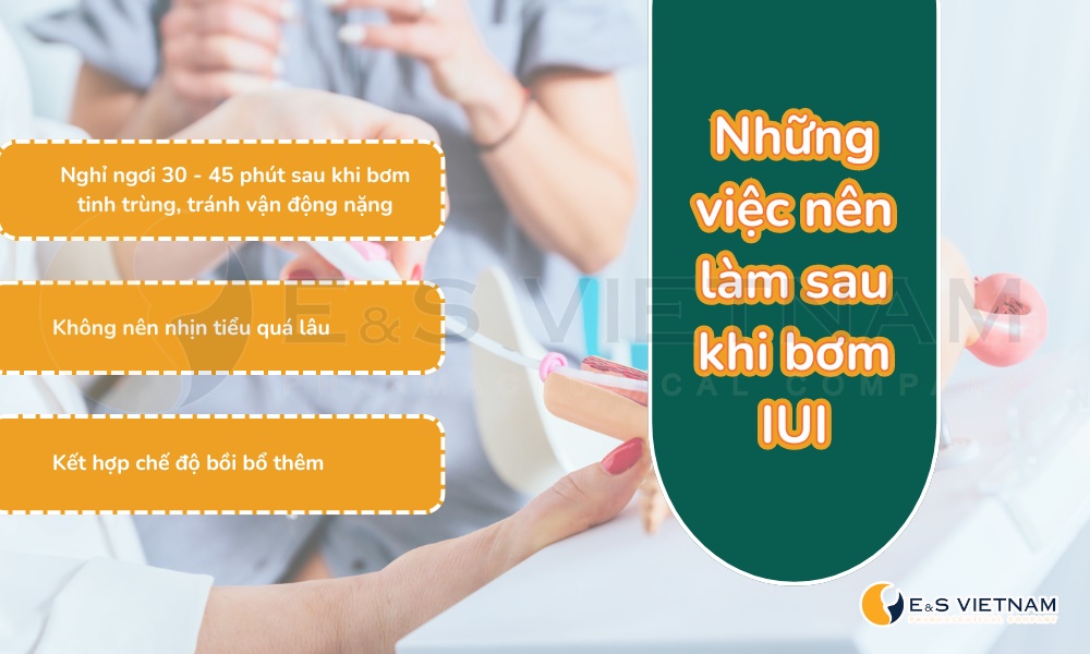 Sau khi bơm IUI nên làm gì