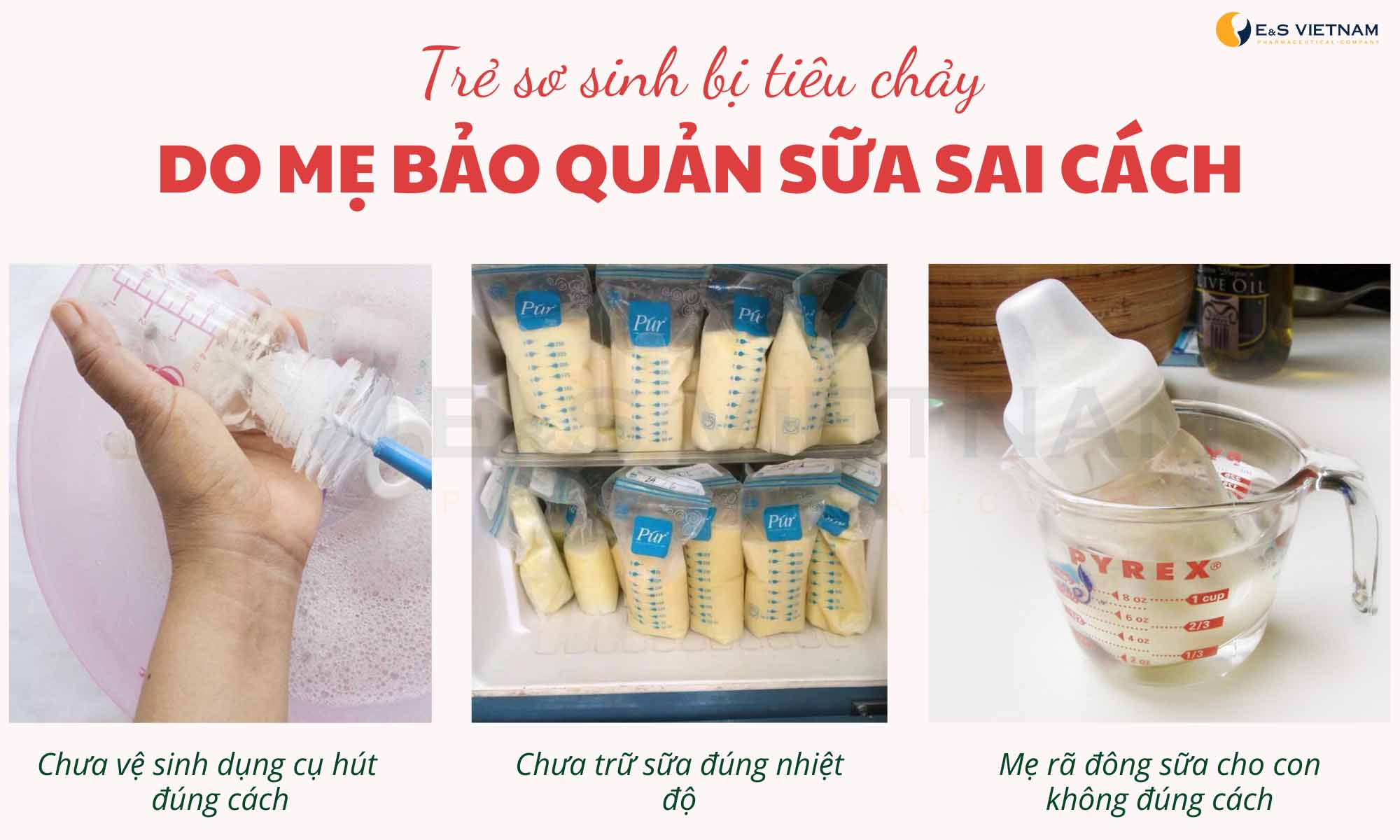 Trẻ sơ sinh bị tiêu chảy có thể do mẹ bảo quản sữa không đúng cách