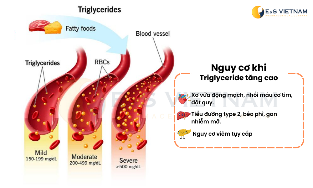 Nguy cơ biến chứng khi Triglyceride tăng cao